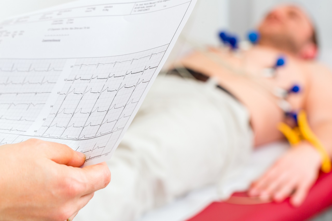 Kiedy należy wykonać badanie EKG?